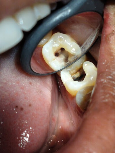 DENTAE2JHFKW_Bidya_multispeciality_dental_clinic_ChIJv8VYNmkx8jkR4SQVGzsbCdw_10