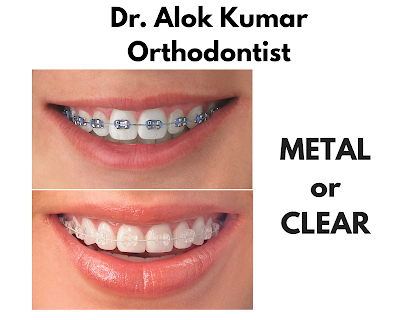 DENTBQTNBEVF_Aashirwad_Dental_Clinic_ChIJJ-9BCptD8jkR42TsKlRhJLo_7