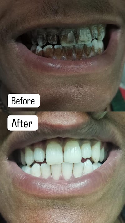 DENTLP8ZQ84R_AMAAN_DENTAL_CLINIC__Dr_Md_Anzar_Anis__ChIJR5hUkrYb8jkR9n0Xzupnrr4_10