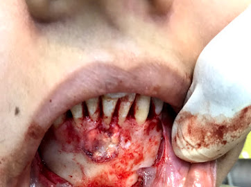 DENTPO91CC3V_Usha_Dental_Clinic_ChIJsTGk079t8jkRZgRfEKAQolE_8