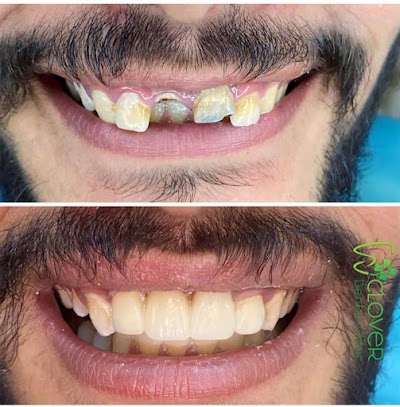 DENTZ3ZJQ4KU_smile_Dental_care__dr_ravi_kumar_BDS_MDS____ex-resident_TMH_mumbai__ChIJg_5G1Uwf8jkRvurApF3LqgU_2