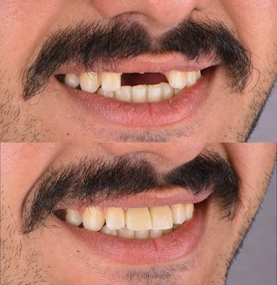 DENTZ3ZJQ4KU_smile_Dental_care__dr_ravi_kumar_BDS_MDS____ex-resident_TMH_mumbai__ChIJg_5G1Uwf8jkRvurApF3LqgU_9