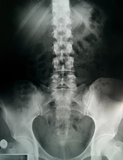 HOSP8MCSQ1UO_Lakhisarai_Skin_and_Orthopedic_Clinic_ChIJvwsDgMUj8jkRgK_HgJ8erMs_5