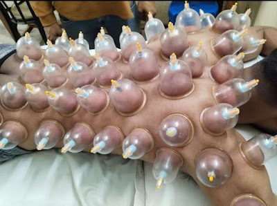 PHYSKOH8OKKY_Sukrit_Acupressur_therapy_kendra_Dr.Mukesh_Singh_ChIJ526DQCAb8jkRyiHG3Ik3Wbg_5