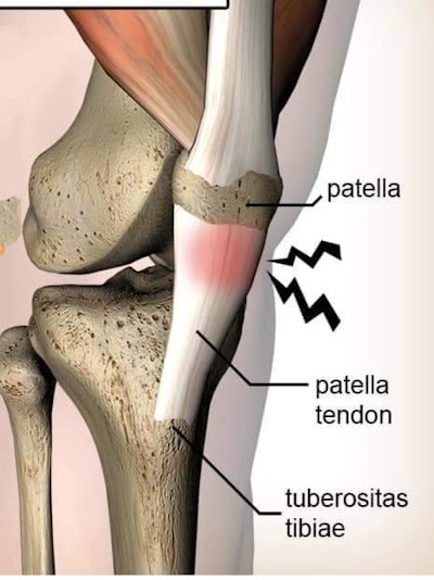 PHYSKOH8OKKY_Sukrit_Acupressur_therapy_kendra_Dr.Mukesh_Singh_ChIJ526DQCAb8jkRyiHG3Ik3Wbg_6