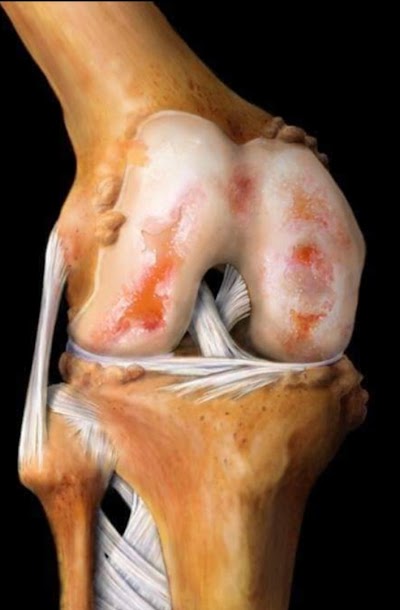 PHYSKOH8OKKY_Sukrit_Acupressur_therapy_kendra_Dr.Mukesh_Singh_ChIJ526DQCAb8jkRyiHG3Ik3Wbg_9